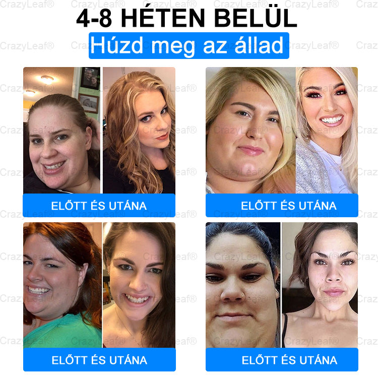 A Pécsi Tudományegyetem ajánlásával – Vezető GLP-1 tapasz Magyarországon HOUKEA® Nano Mikrotűs Tapasz SMGT-GLP-1 + Kollagén + Matrixyl 3000 Zsírégetés • Bőrfeszesítés • Vércukor-egyensúly • 7 nap alatt látható eredmény • Injekció nélkül